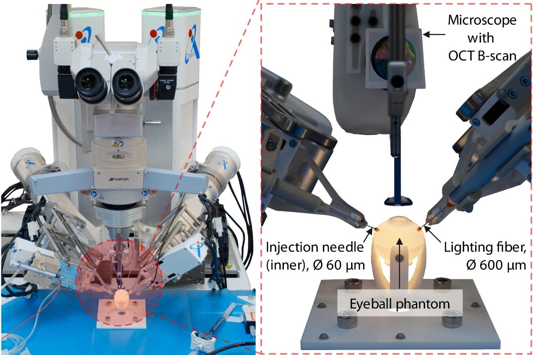 Chinese researchers develop eye surgery robot