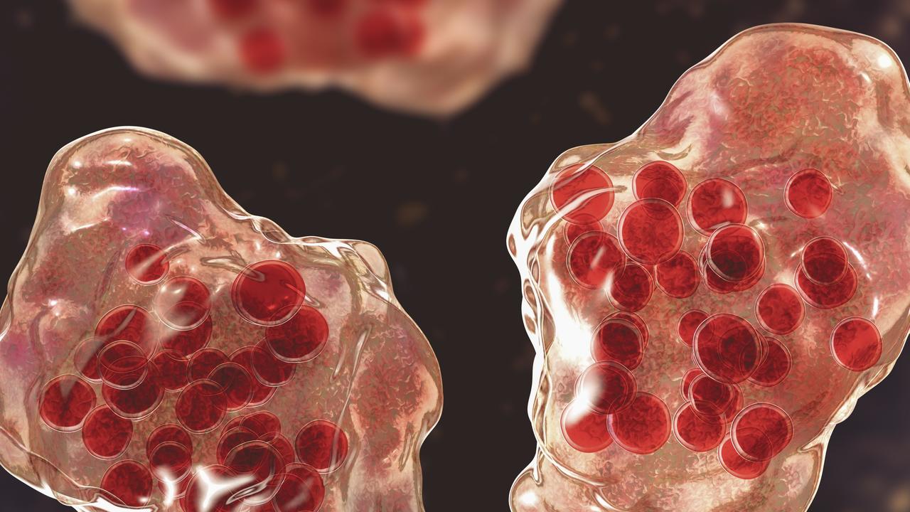 NSW Health warning Sydney residents after cases of measles confirmed