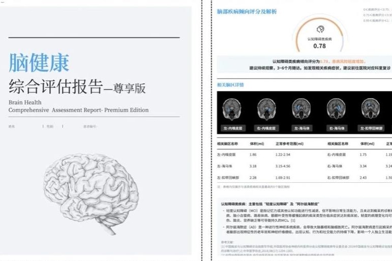 Research establishes brain normative references for Chinese population