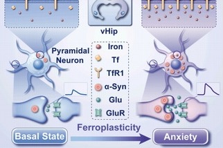 Elevated iron levels key to social anxiety