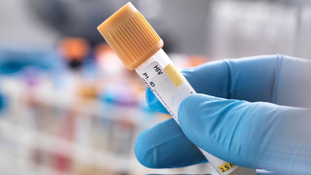 Parents accused of hiding daughter’s HIV infection and neglect