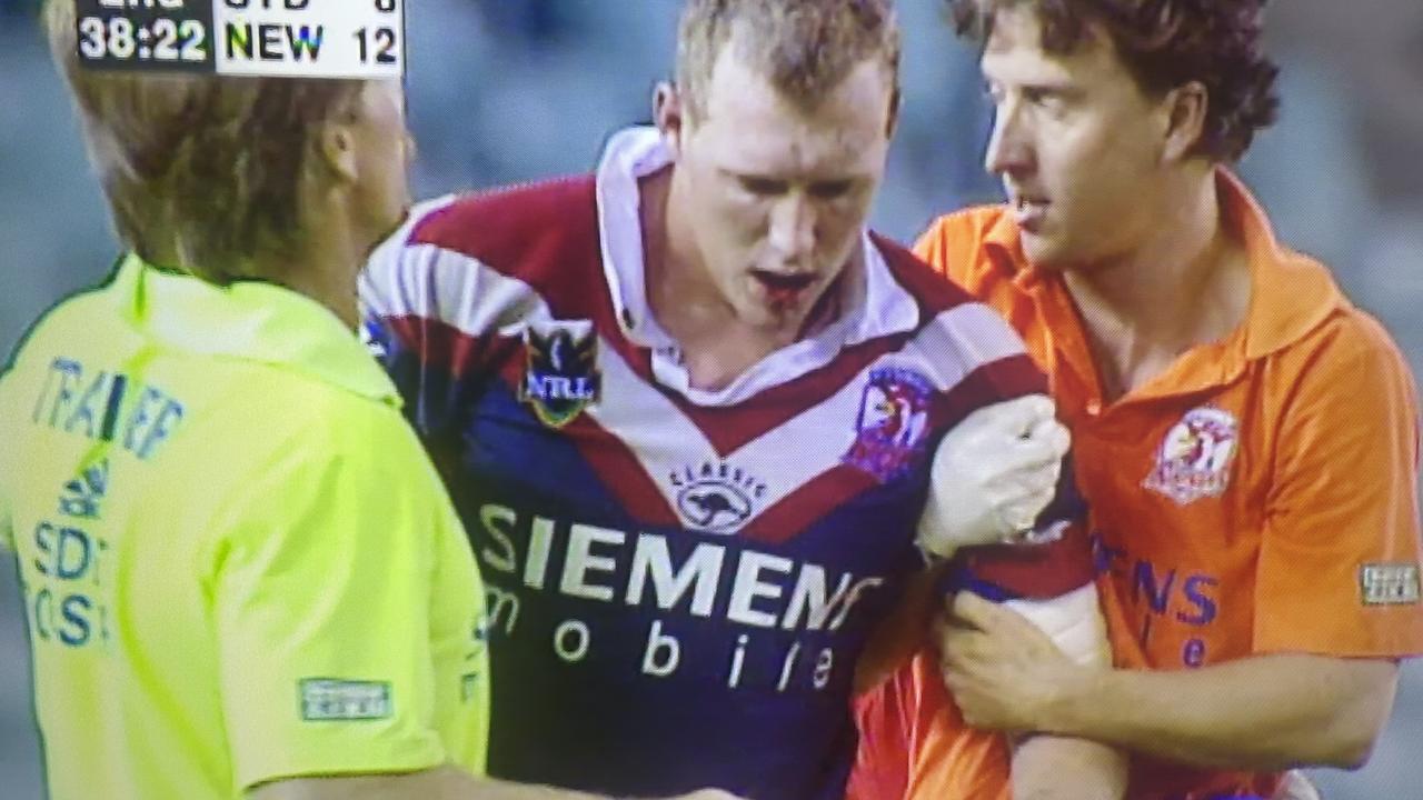 ‘Folded my teeth back’: The gruesome moments that defined Craig Fitzgibbon’s heroics as a player and coach