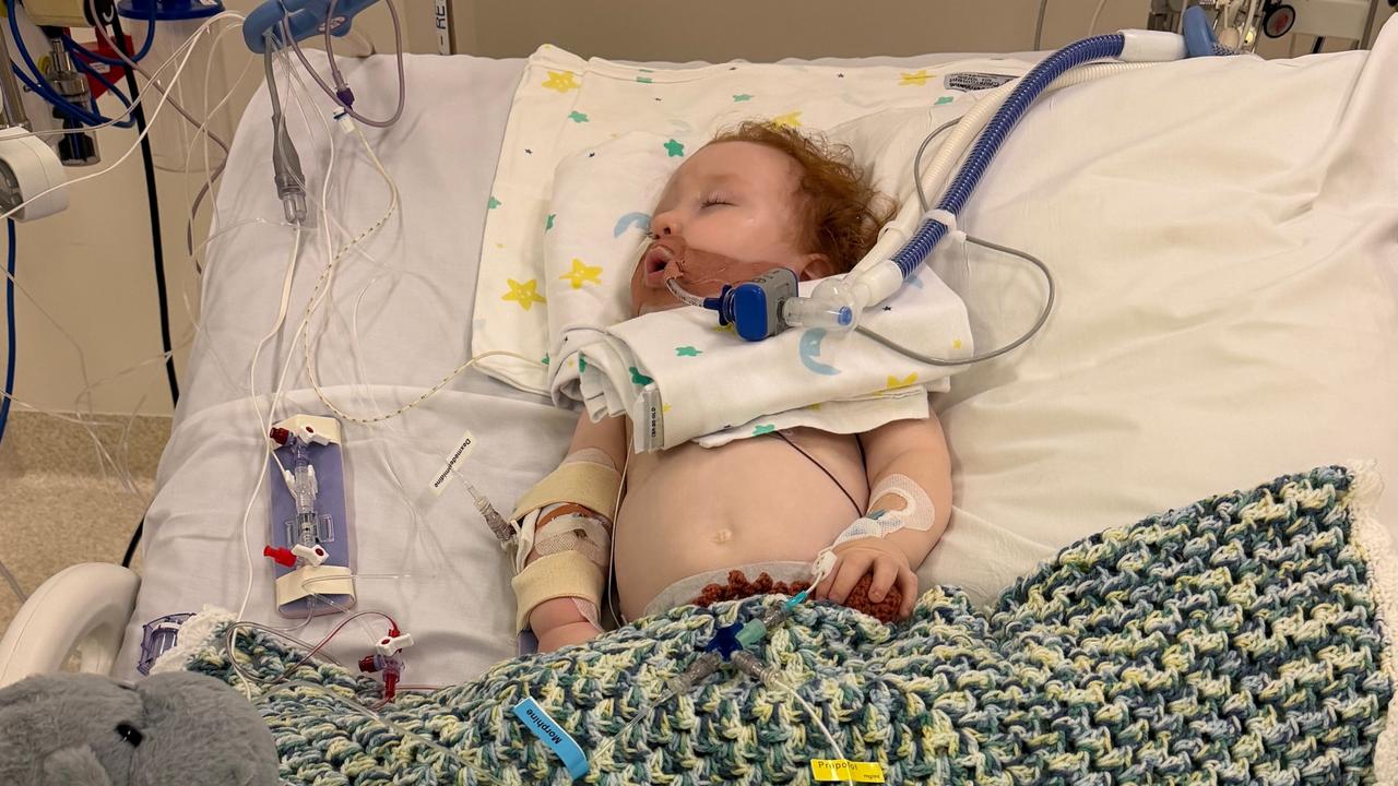 Toddler in induced coma after inhaling dust while baking Bluey-themed birthday cake