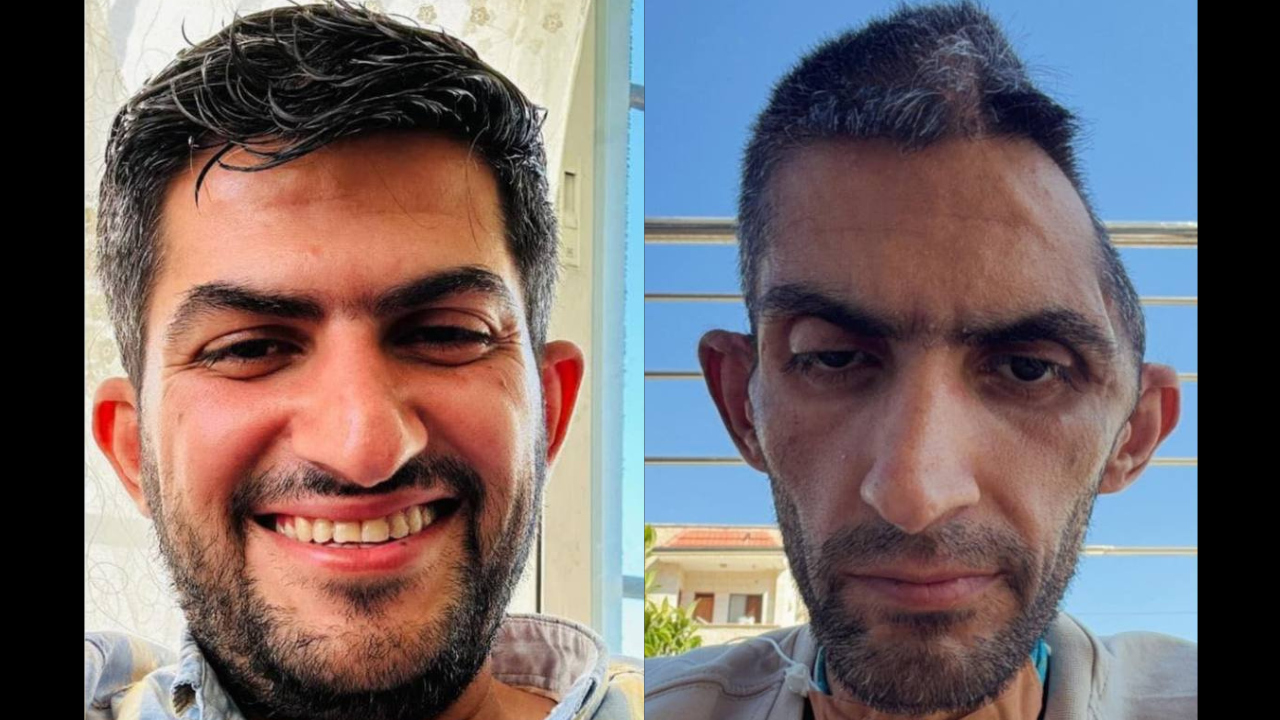 ‘The face of a tortured man’: Photos of Palestinian journalist released from Israeli prison spark outrage