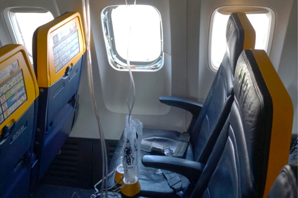 Broken engine parts shattered the Ryanair plane window that a passenger’s head got sucked into: NTSB